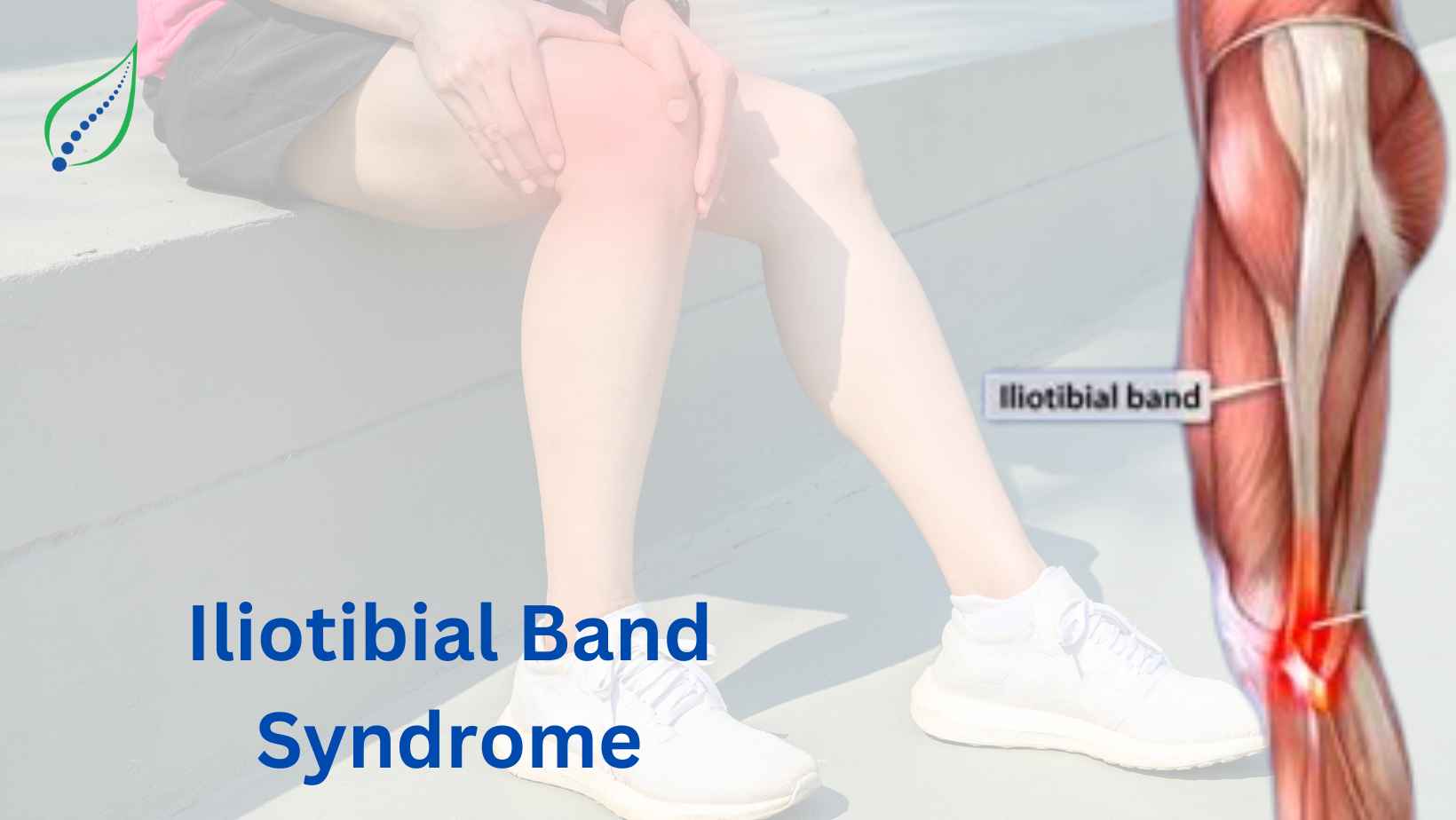 Iliotibial Band Syndrome